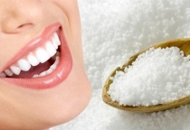Tẩy Trắng Răng Tại Nhà Các Phương Pháp Hiệu Quả và An Toàn