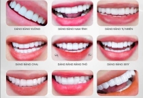 dan-su-veneer
