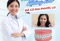 Niềng Răng