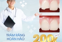 TRÁM RĂNG HOÀN HẢO CHỈ TỪ 200K