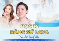  BỌC 16 RĂNG SỨ LAVA