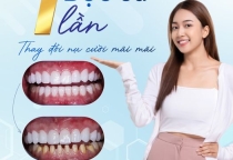 BỌC SỨ 1 LẦN - THAY ĐỔI NỤ CƯỜI MÃI MÃI