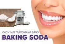 Cách làm trắng răng tại nhà Bí quyết có hàm răng sáng bóng tự nhiên