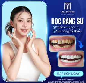BỌC RĂNG SỨ KHU VỰC ĐỒNG NAI