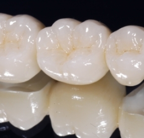Răng sứ Nacera Q3