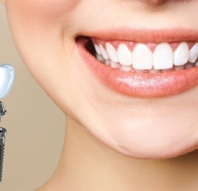 Điều trị sâu răng