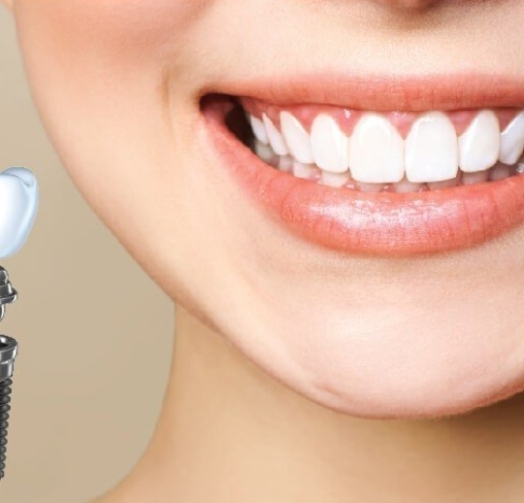 Điều trị sâu răng