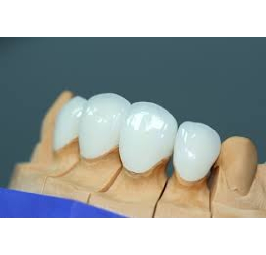 Răng sứ Emax