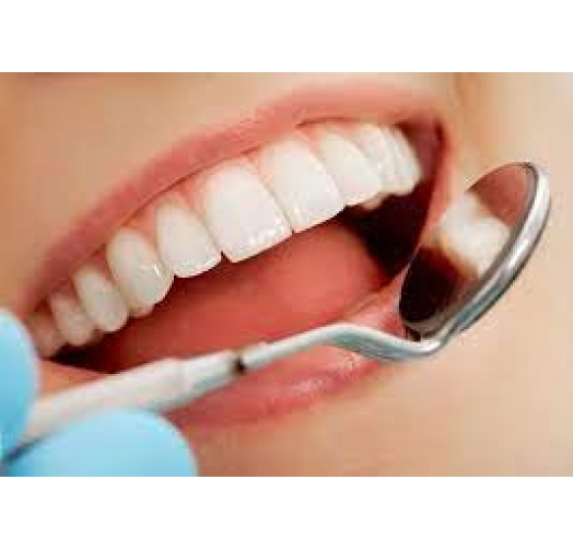 Răng sứ cercon HT