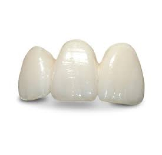 Răng sứ Emax