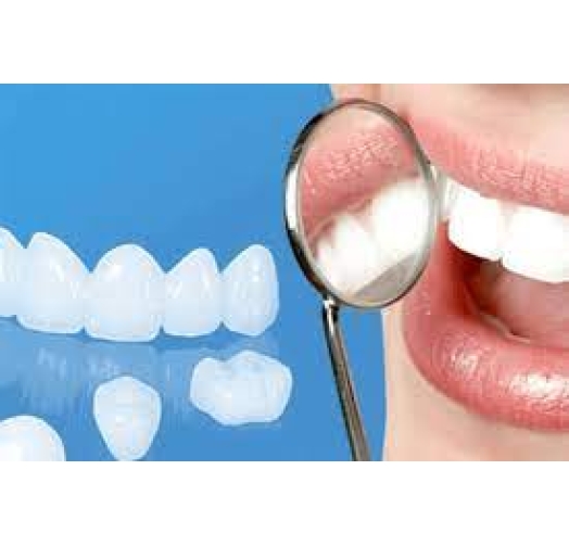 Răng sứ cercon HT