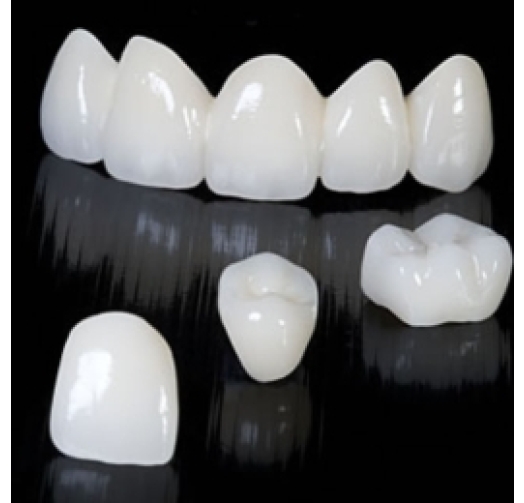 Răng sứ Emax