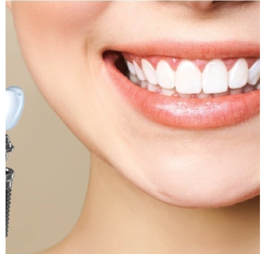 Điều trị sâu răng